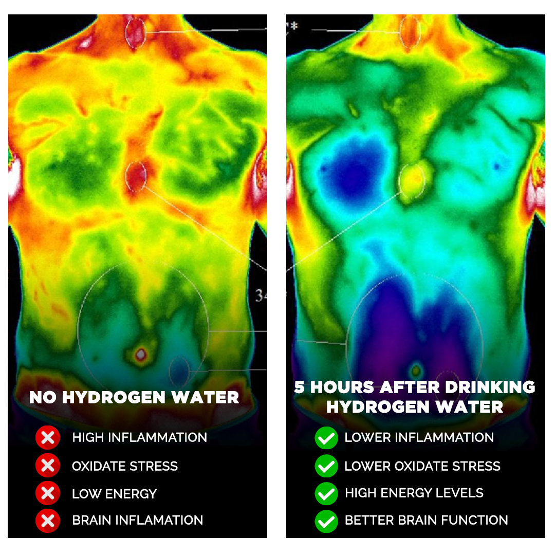 Voior Hydrogen Water Bottle 7 Artboard 3